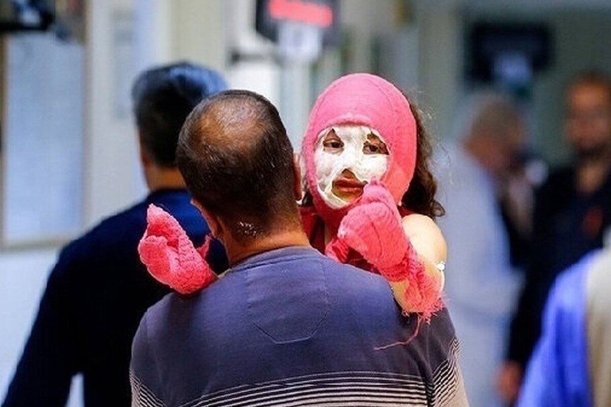 حوادث چهارشنبه سوری همدان سه قطع عضو و ۱۷۱ مصدوم برجا گذاشت