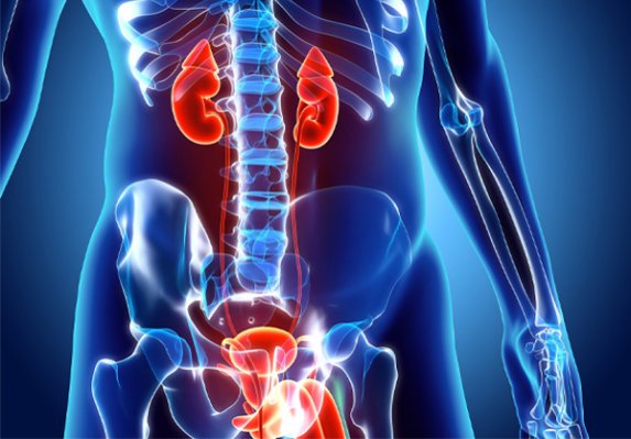 افتادگی مثانه یا سیستوسل یکی از عوامل عفونت ادراری در بانوان است